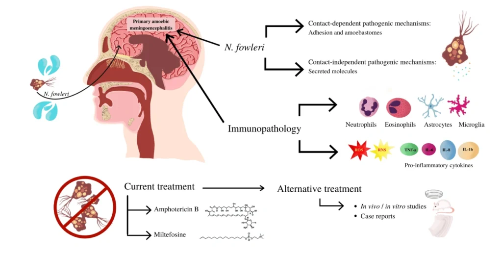 Primary Amoebic Meningoencephalitis (PAM):