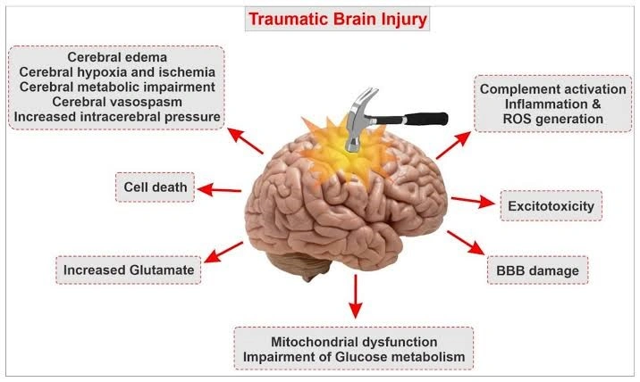 Traumatic Brain Injury: