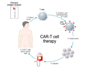 CAR-T Cell Therapy